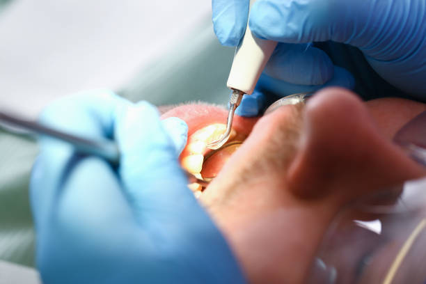 Best Emergency Gum Treatment in Robinson, IL