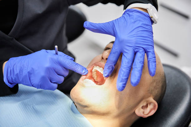 Best Emergency Tooth Extraction in Robinson, IL